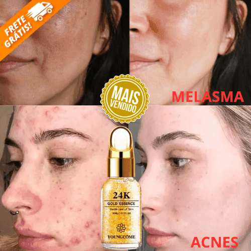 Sérum ESSENCE - XÔ MELASMA E MANCHAS - RESULTADOS NO PRIMEIRO USO + BRINDE EXCLUSIVO - Minha loja